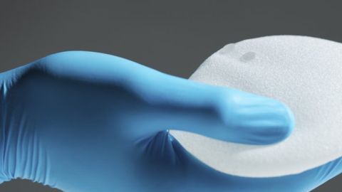 El Linfoma Anaplásico de Células Grandes asociado a implantes de mama es un tipo de cáncer raro.