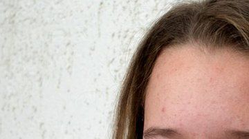 ¿Cuánta relación existe entre lo que comes y el estado de tu piel?