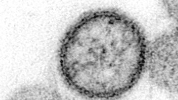 El hantavirus no tiene cura.