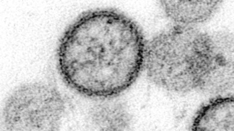 El hantavirus no tiene cura.