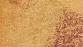 El operativo se hizo en una vivienda de $1 millón de dólares.