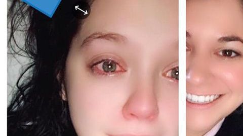 Solo quería trenzarse en el pelo a pesar de estar en el hospital.