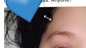 Solo quería trenzarse en el pelo a pesar de estar en el hospital.