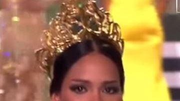 Tovar pensó que perdería el dedo por culpa del anillo.