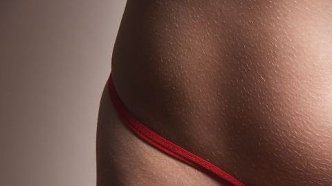 Es una de las prendas preferidas de las mujeres pero que puede resultar peligrosa.