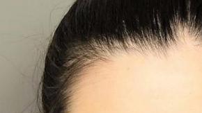 Pareja es acusada de torturar a sus niños con salsa picante.