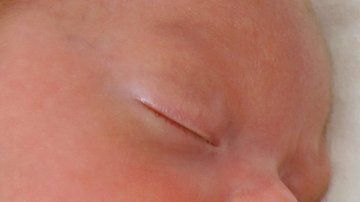 Los gemelos idénticos son invariablemente del mismo sexo, pero un caso en Australia fue la excepción.