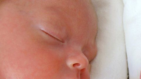 Los gemelos idénticos son invariablemente del mismo sexo, pero un caso en Australia fue la excepción.