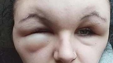 El rostro de la joven quedó deforme.