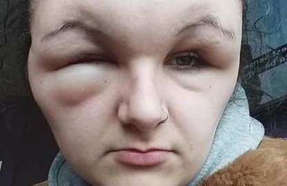 El rostro de la joven quedó deforme.