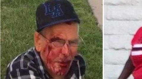 El anciano mexicano que reside legalmente en EE.UU. quedó tendido en la acera con heridas en el rostro y varias costillas rotas.