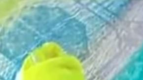 La piel de Jesús Antonio se ha tornado amarilla y tiene marcas extrañas en la espalda.