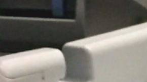 Niño con una malformación se somete a una cirugía labial.