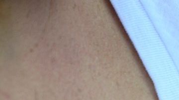 Si tienes implantes, nada te impide amamantar.