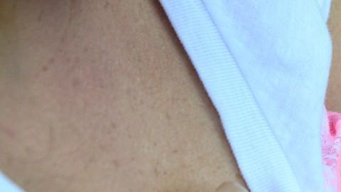 Si tienes implantes, nada te impide amamantar.