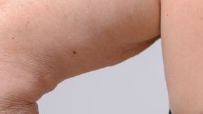 No todo es dieta y ejercicio.