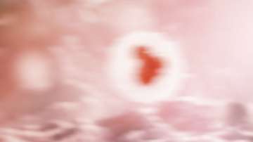 Así se ven las células cancerosas dentro del cuerpo.