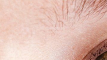 La disputa es por un medicamento para tratar los ojos resecos.