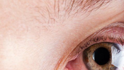 La disputa es por un medicamento para tratar los ojos resecos.