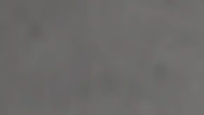 La joyería anticonceptiva es una alternativa.