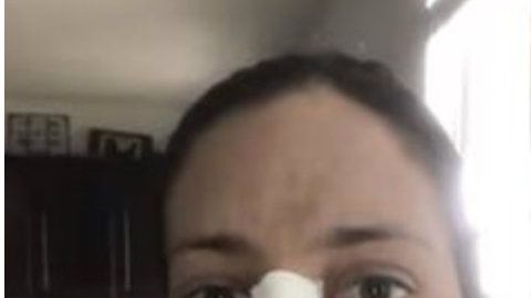 Varias cirugías se realizó esta mujer para verse como la duquesa de Sussex.