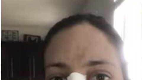 Varias cirugías se realizó esta mujer para verse como la duquesa de Sussex.