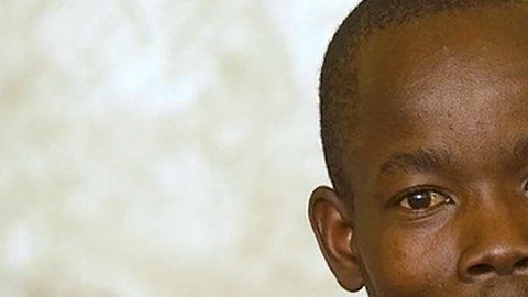 Un hombre se opera los genitales debido a su excesivo tamaño.