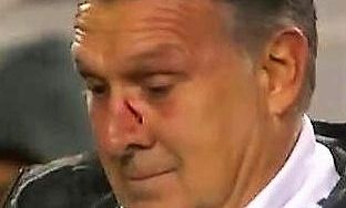 El 'Tata' Martino recibió un balonazo en el México-Paraguay.