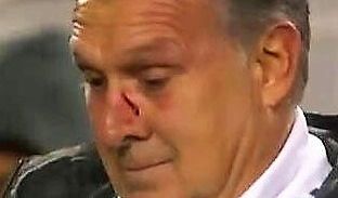 El 'Tata' Martino recibió un balonazo en el México-Paraguay.