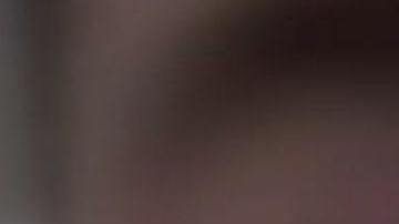 Medina le envío a su esposa un foto de su rostro tras la pelea.