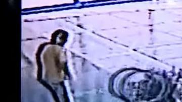 La joven sufrió varias y fuertes heridas en el rostro.