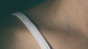 La mastectomía puede realizarse de manera preventiva.