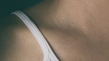 La mastectomía puede realizarse de manera preventiva.