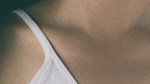 La mastectomía puede realizarse de manera preventiva.