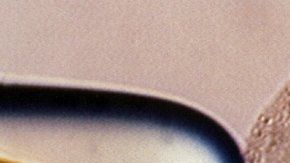 El bebé fue concebido mediante una técnica experimental.