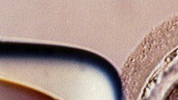 El bebé fue concebido mediante una técnica experimental.