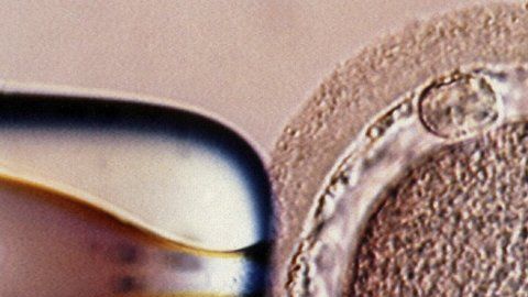 El bebé fue concebido mediante una técnica experimental.