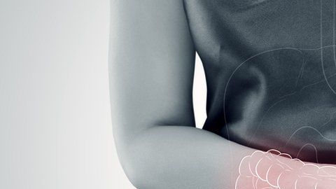 No hay una prueba concreta para diagnosticar el síndrome del colon irritable.