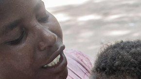 La vacuna ya ha sido administrada en programas pilotos.