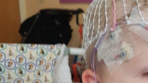 Charlie pasó los primeros dos años de su vida en hospitales.