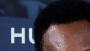 Pelé tuvo que ser hospitalizado en París