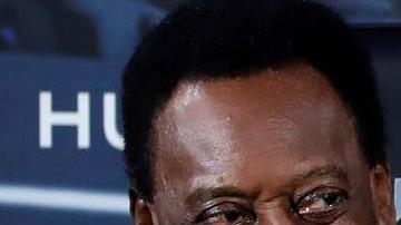 Pelé tuvo que ser hospitalizado en París