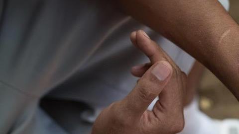 El excarcelado 'preso político' Jefry José Ortega Orozco muestra las heridas que asegura le hizo la policía al momento de su detención,.