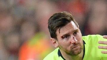 Messi terminó con el rostro lleno de sangre, por un manotazo de Christopher Smalling