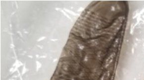 El condón fotografiado por los padres de la niña.