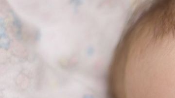 dermatitis-en-bebc3a9s