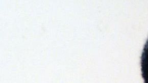 Juan José "La Cobra" Muñante fue también mundialista en Argentina 78 con la selección de Perú