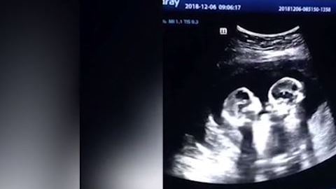 Las gemelas parecieran darse unos cuantos golpes.