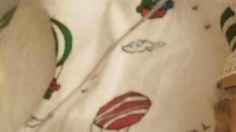 Marcus Albers se encuentra en la unidad de cuidados intensivos del Hospital de Niños de Wisconsin.