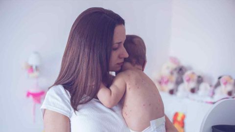 No solo los niños pueden contraer el sarampión. Los adultos están en riesgo también.